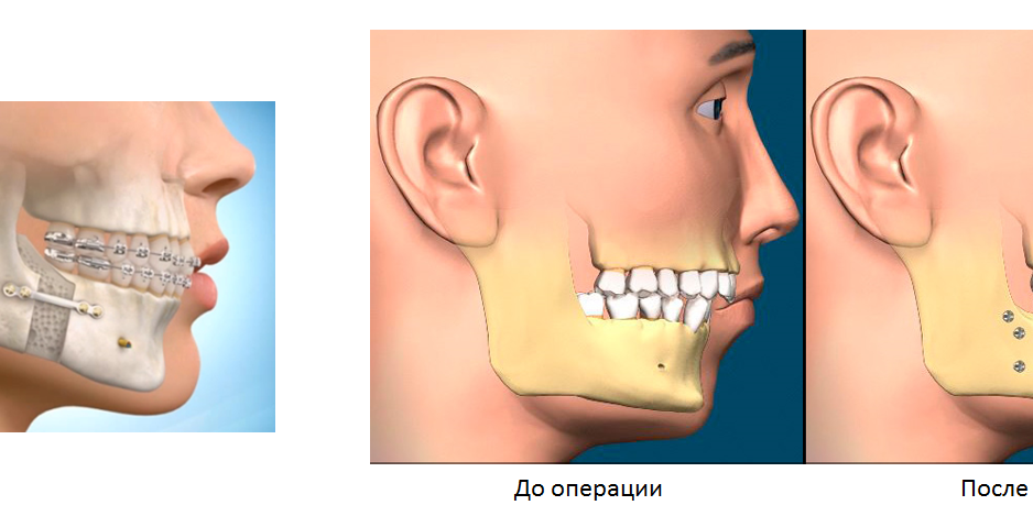 операции-на-челюсти